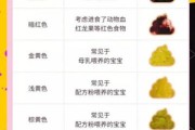 宝宝拉灰白色大便怎么回事_灰白色大便正常吗