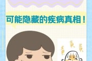 2岁宝宝脸色发黄是什么原因_需要做什么检查