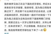 梦到门牙松动是什么意思_梦到门牙松动怎么办