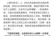 胎心监护宝宝不动怎么办_胎心监护宝宝不动的原因
