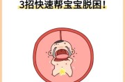 宝宝脐带绕颈怎么办_脐带绕颈一周能顺产吗