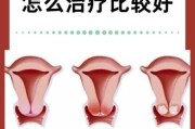 宫颈图片大全_正常与病变对比图怎么看