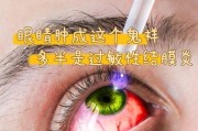 宝宝早上起床眼睛肿怎么回事_宝宝眼睛肿怎么快速消肿