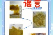 宝宝拉沫是什么原因_宝宝拉沫怎么办
