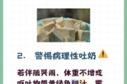 新生宝宝吐奶像豆腐渣怎么回事_需要看医生吗