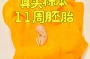 11周胎儿大小_怀孕11周宝宝发育图怎么看