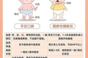 宝宝喉咙长泡发烧怎么办_喉咙疱疹反复高烧