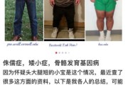 侏儒症宝宝有什么表现_侏儒症宝宝能长高吗