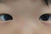 宝宝对眼怎么判断_婴儿对眼正常吗