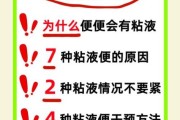 一个月宝宝大便有粘液正常吗_新生儿大便粘液原因