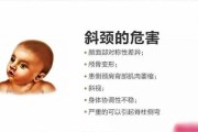 宝宝歪头看东西正常吗_婴儿斜颈如何早期发现