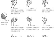 骨折图片大全_骨折类型有哪些
