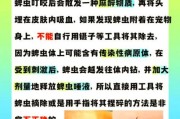 梦到蜱虫是什么意思_如何化解