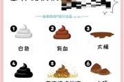 宝宝粑粑白色怎么回事_宝宝拉白色大便怎么办