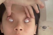 宝宝眼睛往上翻白眼是怎么回事_新生儿翻白眼正常吗