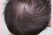 两个旋的宝宝性格特点_两个旋的宝宝聪明吗