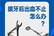 梦到拔牙是什么意思_梦到拔牙出血怎么办