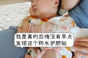 满月宝宝肚脐出血怎么办_满月宝宝肚脐出血正常吗