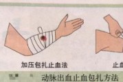 流血图片大全_如何快速止血