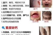 宝宝缺钙有哪些症状_怎么判断婴儿是否缺钙