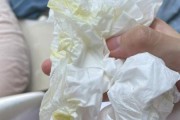 宝宝吐清水怎么回事_宝宝吐清水需要看医生吗