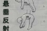 宝宝脑瘫早期症状有哪些_八个动作筛查图怎么看