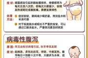 宝宝拉肚子但精神很好怎么办_需要看医生吗