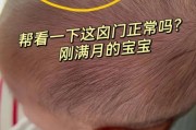 五个月宝宝囟门凹陷怎么回事_怎么判断脱水还是正常