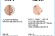 鼻子类型图解_塌鼻梁怎么改善
