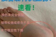梦到崴脚是什么意思_梦到崴脚预示什么