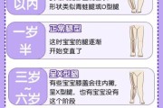 14个月宝宝o型腿图片_正常还是缺钙