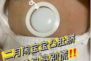 宝宝脐疝怎么办_脐疝会自愈吗