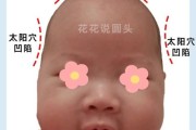 宝宝额头突出高正常吗_宝宝额头突出高图片对比