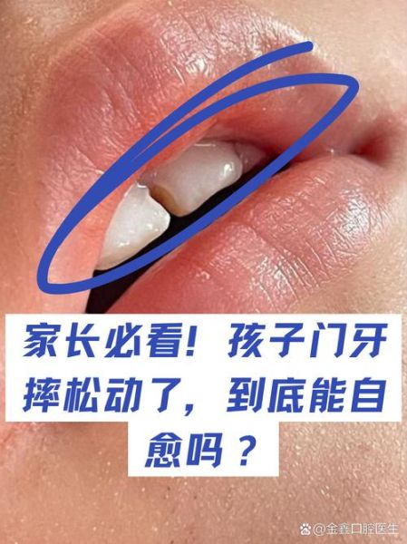 梦到门牙松动是什么意思_梦到门牙松动怎么办