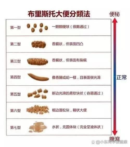 2个月宝宝不拉大便怎么办_婴儿便秘怎么快速排便