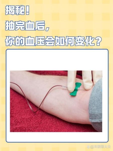 宝宝抽静脉血的危害_婴儿静脉抽血风险