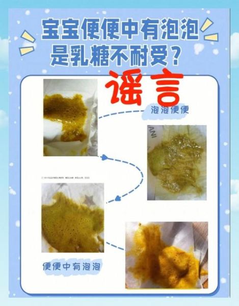 宝宝拉沫是什么原因_宝宝拉沫怎么办