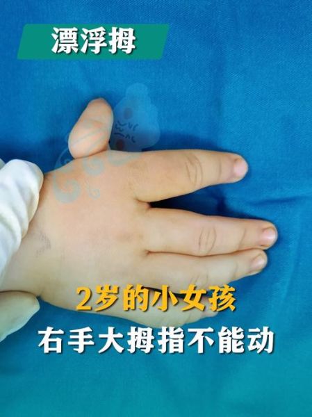 宝宝右手比左手灵活_需要纠正吗