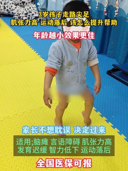 宝宝肌张力高有什么影响_会不会影响走路