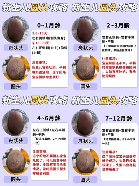 女宝宝什么头型好看_怎么睡出漂亮头型