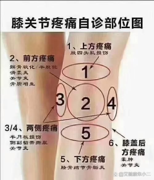 腿疼图片大全_腿疼位置图解对照表