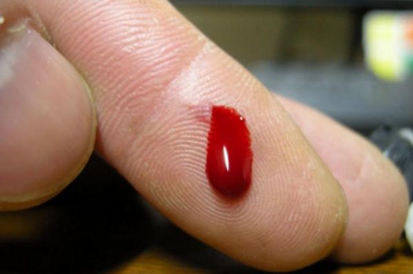 血图片大全_血图片有哪些类型