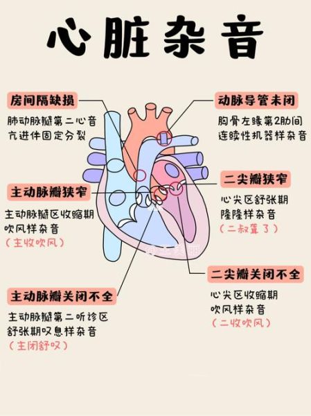 宝宝心脏有杂音是怎么回事_需要手术吗