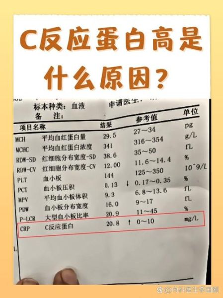 宝宝C反应蛋白30严重吗_需要住院吗