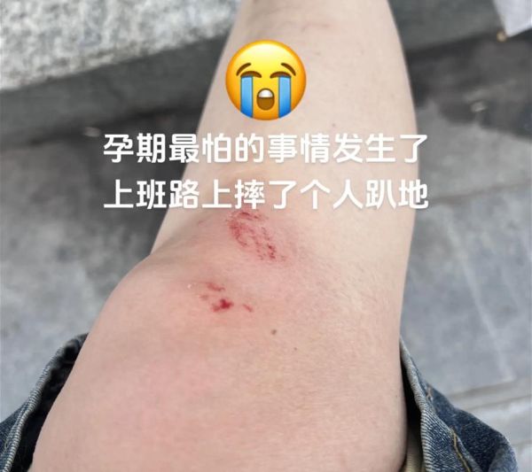 孕妇梦见摔跤预示什么_孕妇梦见摔跤怎么办