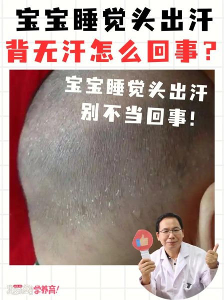 宝宝睡觉额头出汗正常吗_宝宝睡觉额头出汗怎么办