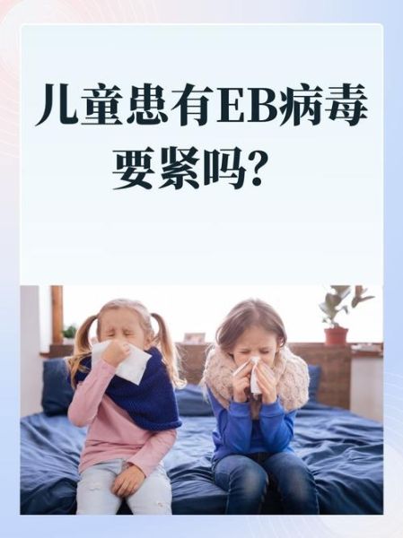 宝宝EB病毒怎么治疗_宝宝EB病毒多久能好