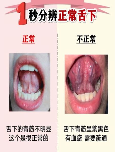 舌头背面正常图片大全_正常舌背是什么样