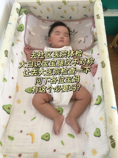 宝宝腿纹不对称图片怎么看_腿纹不对称正常吗