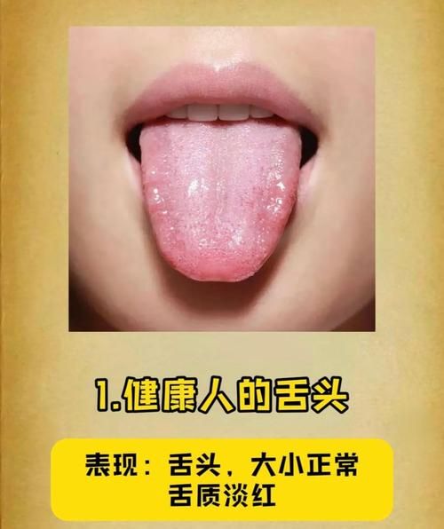 舌头图片大全_正常与异常舌象如何辨别